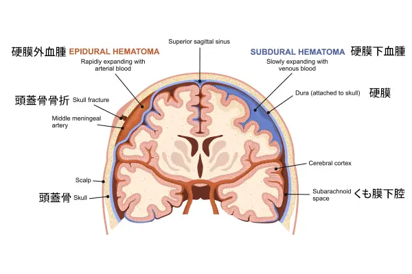 頭部外傷 | かなみやクリニック